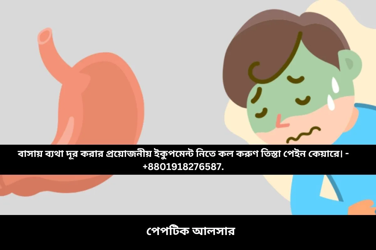 পেপটিক আলসার