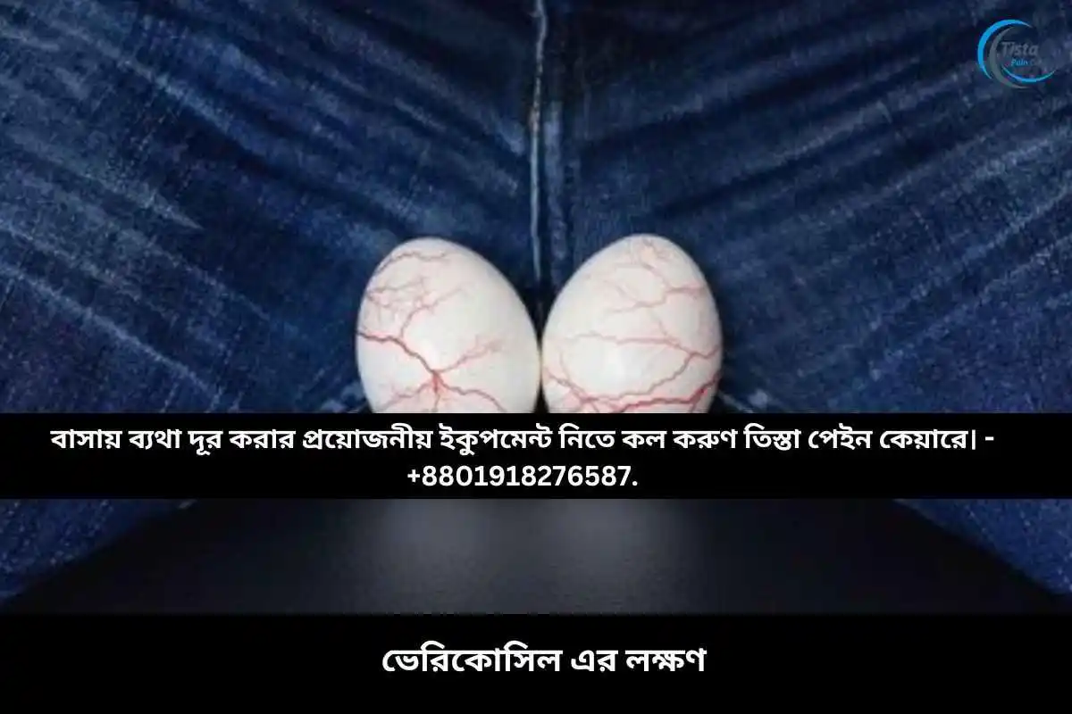 ভেরিকোসিল এর লক্ষণ